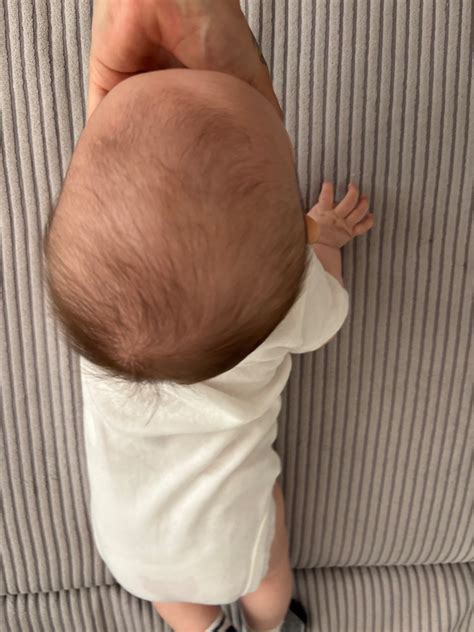 ilustrácia jemného česania šupiniek z hlavičky bábätka