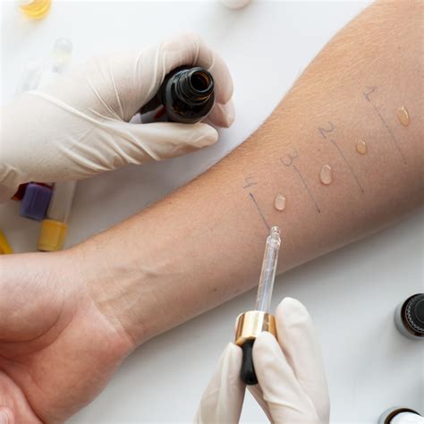 schéma prevedenia kožného prick testu