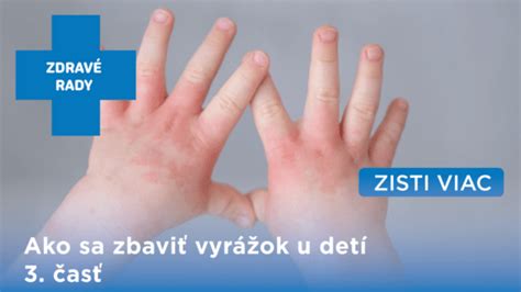 grafické znázornenie rôznych typov vírusových vyrážok u detí