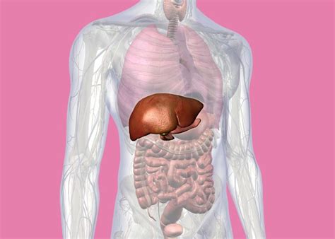 Ilustrácia pečene s označenými patologickými zmenami