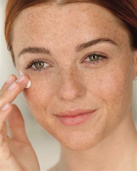 Ukážka pokožky s pigmentovými škvrnami