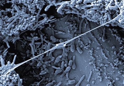 Schema znázorňujúca účinky kyseliny ricínolejovej na baktérie spôsobujúce akné.