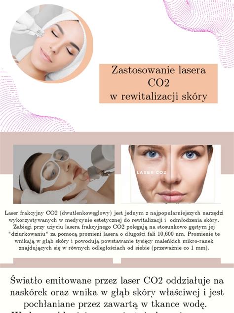 Schéma fungovania CO2 frakčného lasera