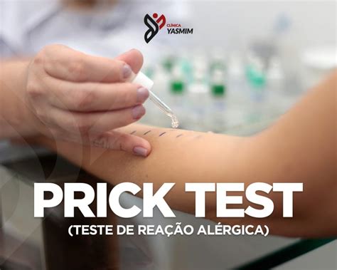 Ilustrácia predlaktia s vyznačenými miestami na prick test
