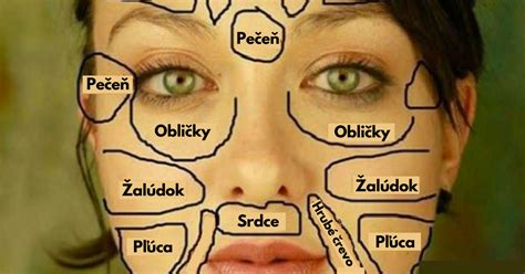Infografika zobrazujúca T-zónu tváre a bežné problémy mastnej pleti