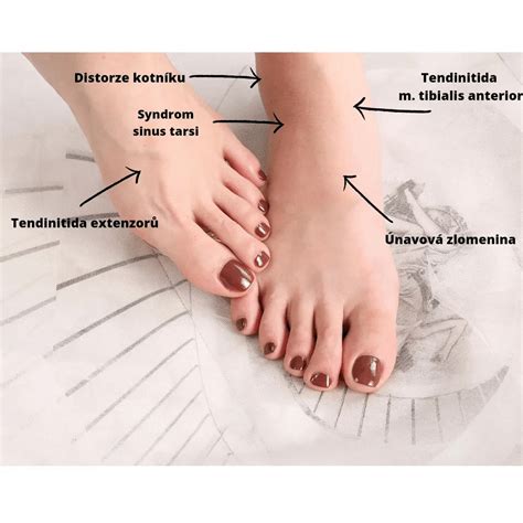 Detail rúk s upravenými nechtami po aplikácii šípkového oleja