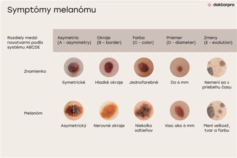 Ilustrácia amelanotického melanómu na koži