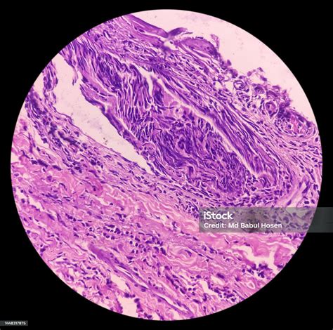 Mikroskopický pohľad na pokožku s viditeľnými pórmi a zväčšenými pórmi.