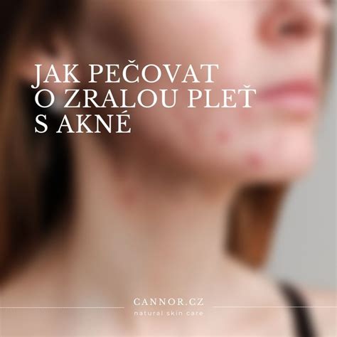 Schéma aplikácie pleťového zmäkčujúceho gélu s fóliou a uterákmi