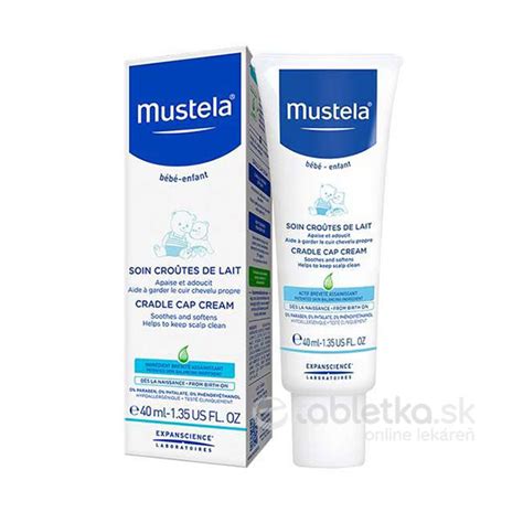 Ilustrácia mliečnej chrasty na hlavičke dojčaťa.