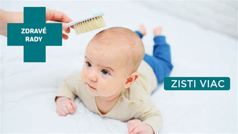 Ilustrácia zobrazujúca mliečnu chrastu na hlavičke dojčaťa