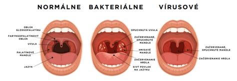 Detailná fotografia vyrážok a začervenania v okolí úst dieťaťa