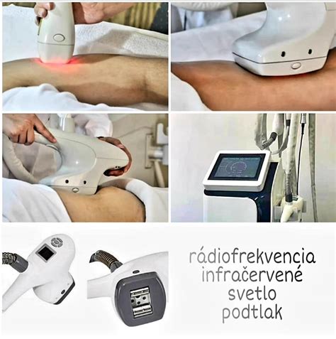 Infografika o princípe rádiofrekvenčnej liečby