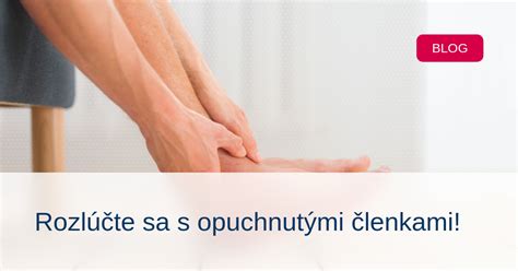 Ilustrácia znázorňujúca opuchnuté členky a lýtka.