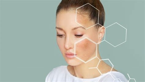 Detail tváre so zosvetlenou pleťou a jemnými pigmentovými škvrnami.