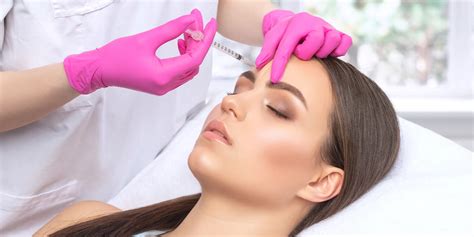 Schéma tváre znázorňujúca body aplikácie botulotoxínu pre efekt zdvihnutia obočia