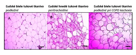 Schéma pôsobenia aktívnych látok (kofeínu a extraktov) na podkožné tukové tkanivo a proces odvodnenia pokožky.