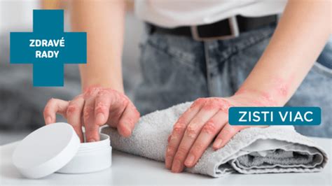 Infografika: Zásady starostlivosti o atopickú pokožku