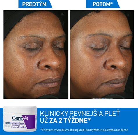Schéma účinku kyselín na obnovu povrchu pleti