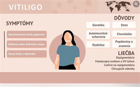 Infografika porovnávajúca rôzne metódy liečby vitiliga, od fototerapie po lokálne prípravky.