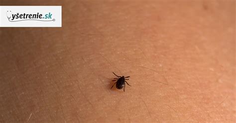 Detailný pohľad na kliešťa prisatého na koži