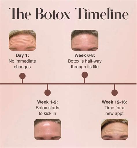 Infografika porovnávajúca klasickú aplikáciu botoxu a techniku Baby Botox.