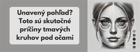 Ilustrácia: tmavé kruhy pod očami