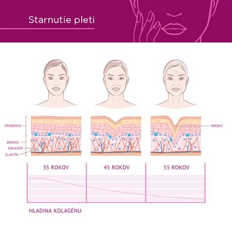 infografika o typoch pleti a ich špecifických potrebách