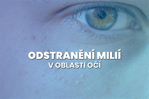 Tematická fotografia ženy s mladistvou pleťou v oblasti očí
