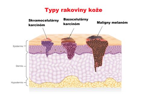 Ilustrácia znázorňujúca rôzne typy kožných vyrážok a lézií.