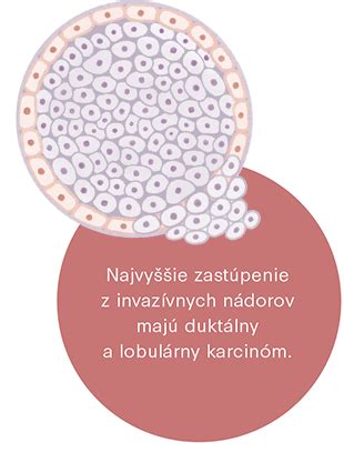 Porovnanie vzhľadu bežného pupienka a bazocelulárneho karcinómu.