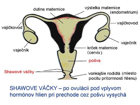 Anatomický diagram ženských vonkajších pohlavných orgánov s vyznačenými Bartholiniho žľazami a cystou