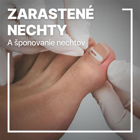 porovnanie prirodzeného nechtu a nechtu spevneného gélovým produktom