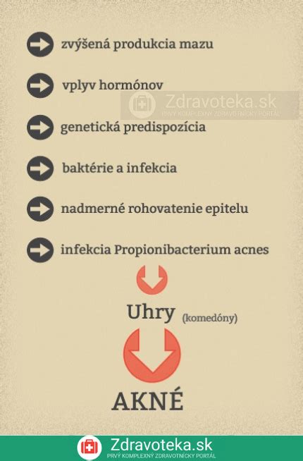 Infografika: Mechanizmus vzniku akné