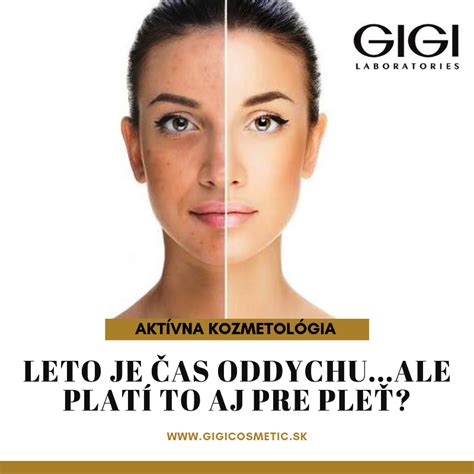 Ukážka rôznych typov hyperpigmentácie na koži