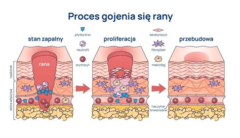 infografika o procese hojenia rany s fázami zápalu, proliferácie a remodelácie