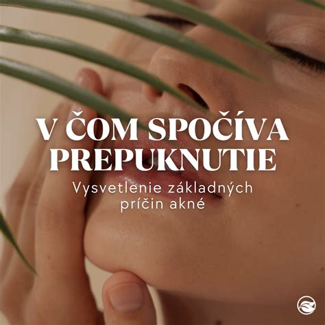 Schéma: Príčiny vzniku akné (upchaté póry, nadprodukcia mazu, baktérie P. acnes)