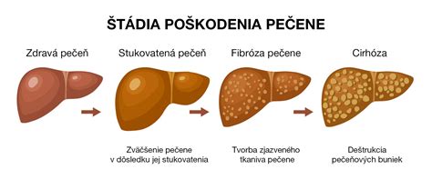 Schematické zobrazenie vrstiev kože s popiskami