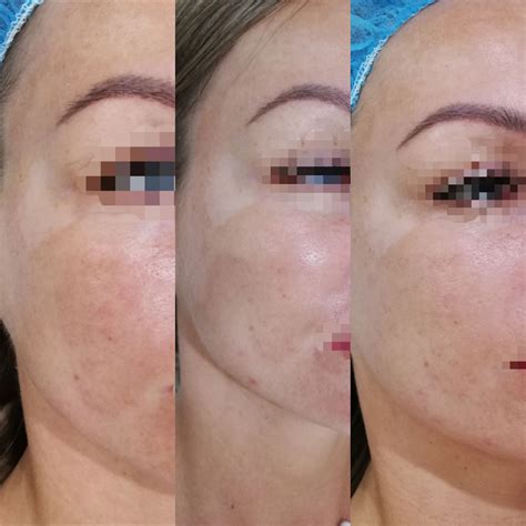 Detail pleti so zredukovanými vráskami a škvrnami