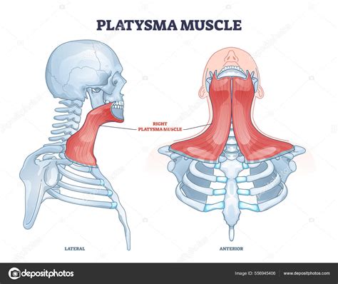 Fotografia: Znázornenie aplikácie botoxu do krčného svalu (platysma)
