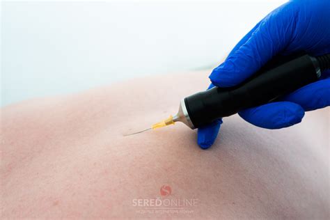 aplikácia injekcie Galmektinu veterinárnym lekárom u ovce