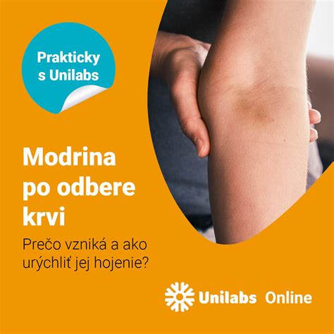 Fotografia ruky s aplikovaným studeným obkladom na miesto vpichu po očkovaní