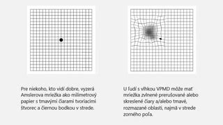 porovnávacia schéma čiernej bodky a folikulárneho filamentu