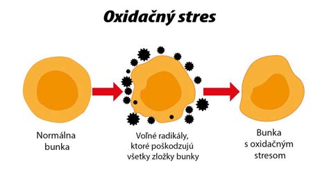 Infografika: Voľné radikály a poškodenie kožných buniek