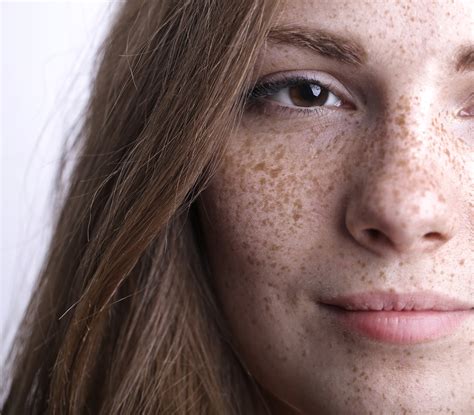 Tematická fotografia ženy s porcelánovou pleťou a jemnými pehami