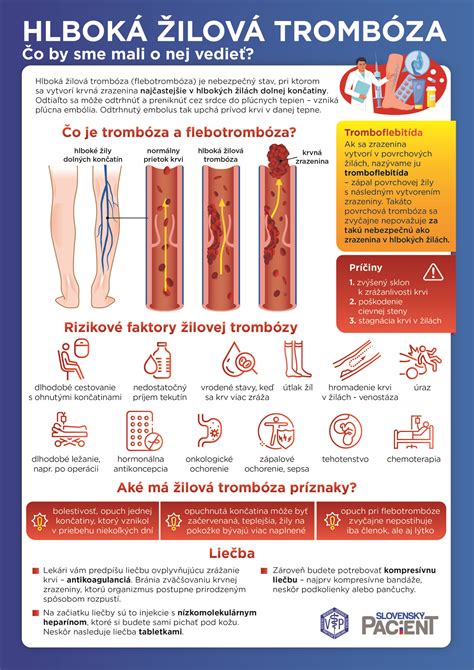 Infografika: Prejavy a progresia rosacey v rôznych štádiách