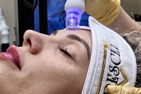 fotografia: hydrafacial ošetrenie alebo laserová terapia