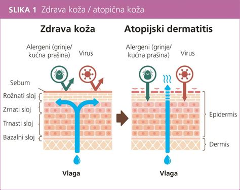 infografika vrstiev kože a prieniku jazvy