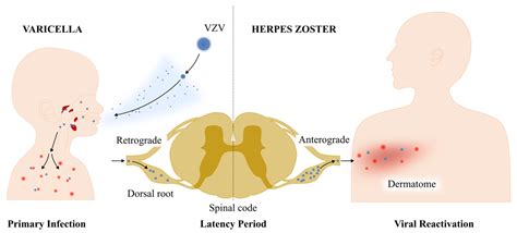 infografika cyklu varicella-zoster vírusu, latencia a reaktivácia