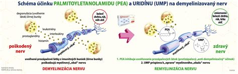 Infografika znázorňujúca typické kožné ochorenia a spôsoby liečby